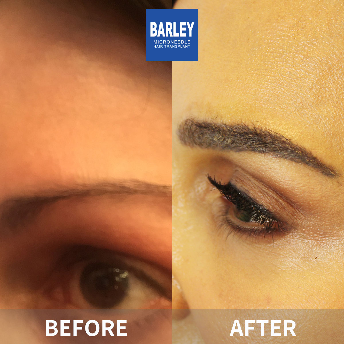 Fuller Brows