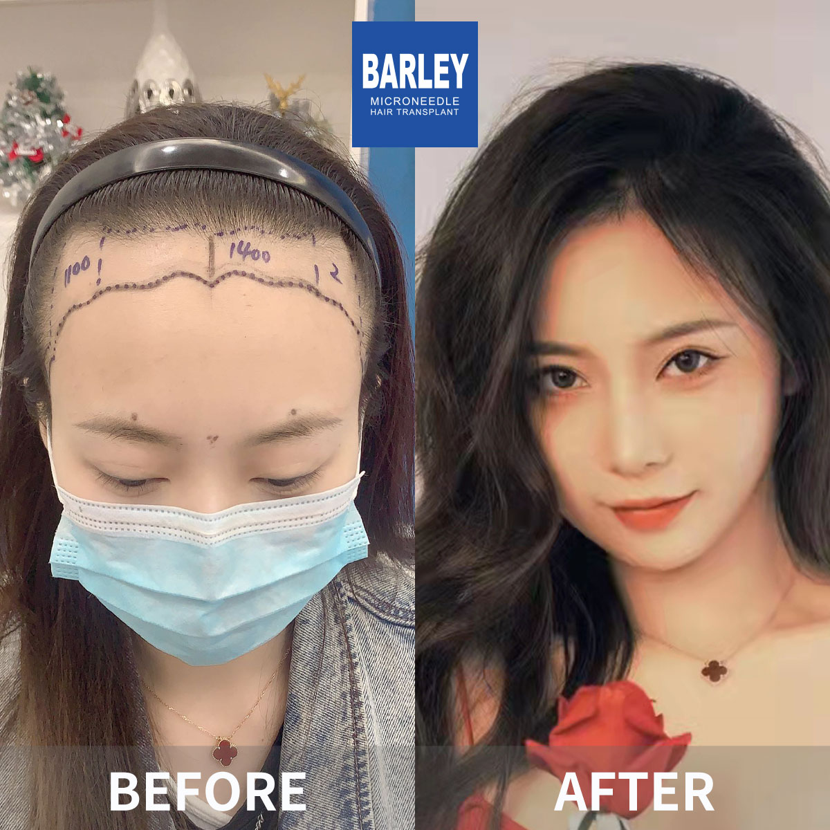 Natural Look
